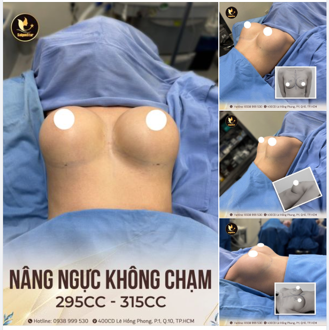 NÂNG NGỰC KHÔNG CHẠM - CHỌN SIZE NHƯ Ý