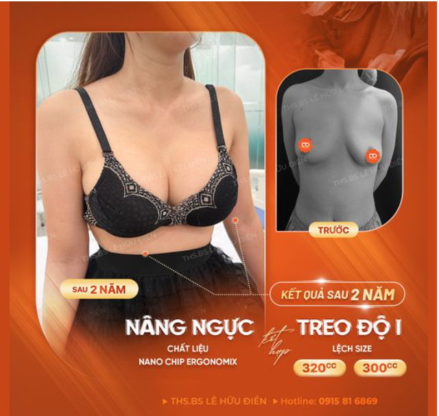 WOW - Feedback Ngực 2 năm siêu căng tròn tự nhiên