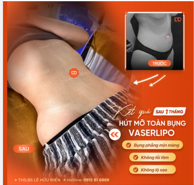 HẾT SẠCH MỠ THỪA - MẶC VỪA SIZE S