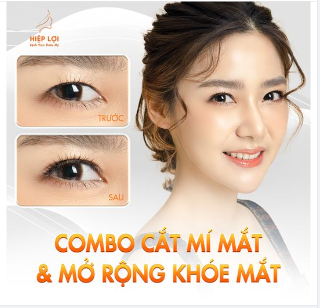 COMBO "Cắt mí mắt" kết hợp "Mở rộng khóe mắt"
