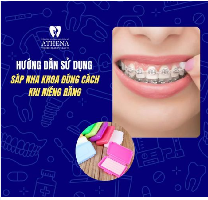 HƯỚNG DẪN SỬ DỤNG SÁP NHA KHOA ĐÚNG CÁCH KHI NIỀNG RĂNG