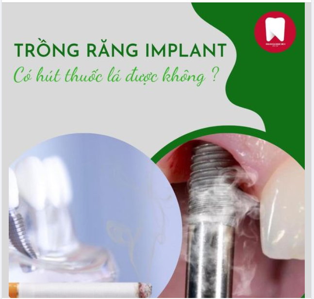 HÚT THUỐC LÁ VÀ TRỒNG RĂNG IMPLANT