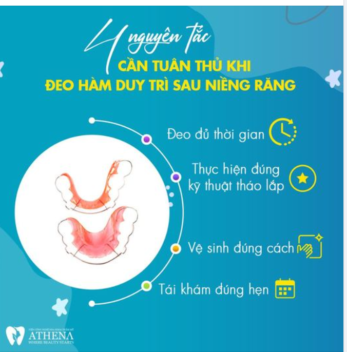 4 NGUYÊN TẮC CẦN TUÂN THỦ KHI ĐEO HÀM DUY TRÌ SAU NIỀNG RĂNG