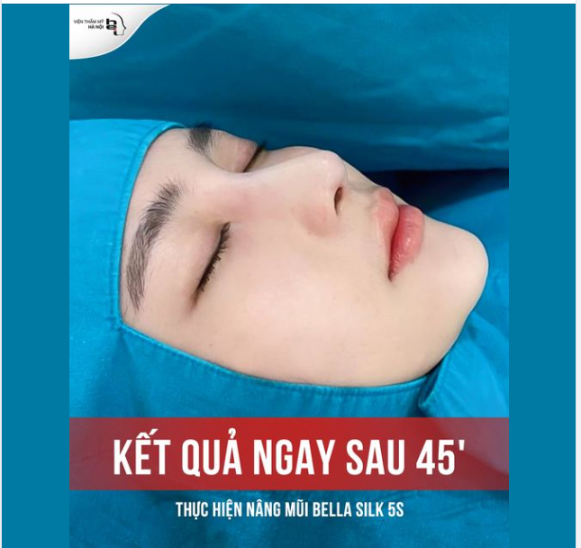 45' THỰC HIỆN MŨI THẤP TẸT HOÁ CAO SANG