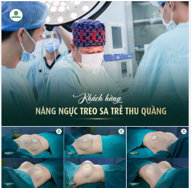 THÍCH V1 TỰ NHIÊN NHƯNG VẪN CĂNG TRÒN HÚT MẮT.