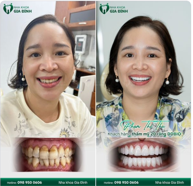 TÂN TRANG NỤ CƯỜI - TÌM LẠI CẢ THANH XUÂN