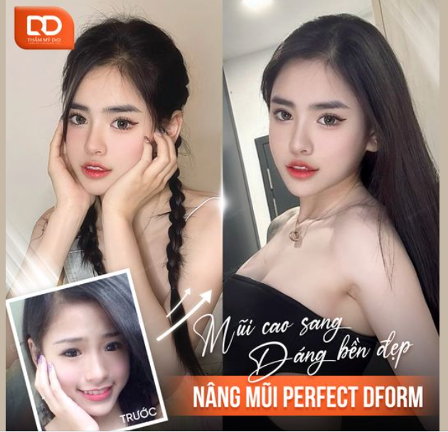 SỞ HỮU DÁNG MŨI ĐẸP BỀN LÂU VỚI 5 ĐIỂM KHÁC BIỆT TẠI DrD