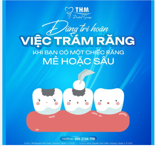 ĐỪNG TRÌ HOÃN VIỆC TRÁM RĂNG KHI BẠN CÓ MỘT CHIẾC RĂNG MẺ HOẶC SÂU