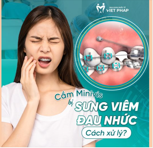 CÁCH XỬ LÝ KHI CẮM MINIVIS BỊ SƯNG VIÊM VÀ ĐAU NHỨC
