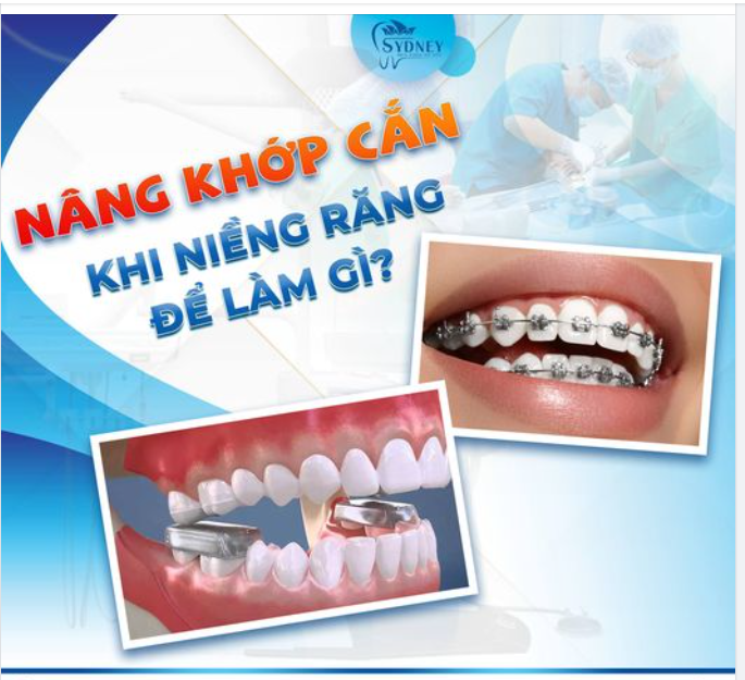 NÂNG KHỚP KHI NIỀNG RĂNG ĐỂ LÀM GÌ?