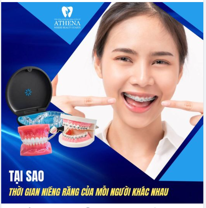 Vì sao cùng “niềng răng” mà kết quả và thời gian niềng khác nhau?