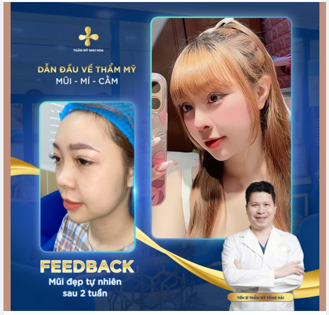 2 tuần để có dáng mũi hoàn hảo - Tin nổi không?