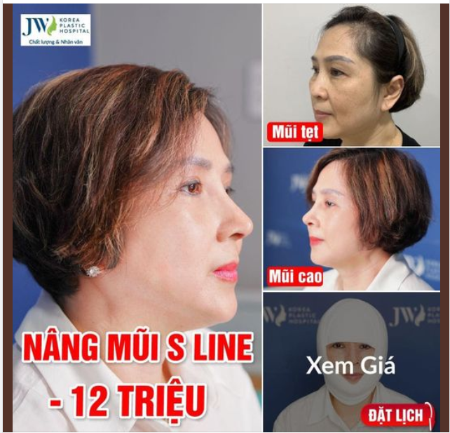 Nữ Việt kiều Na Uy VƯỢT HƠN 9.000KM đến JW Nâng mũi S Line