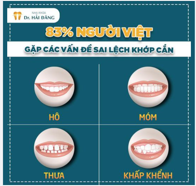 Tại nha khoa Hải Đăng - với 16 năm kinh nghiệm đã thực hiện thành công hàng ngàn ca niềng răng thẩm mỹ giúp khách hàng tìm lại sự tự tin sẽ là địa chỉ đáng tin cậy để bạn trao niềm tin!