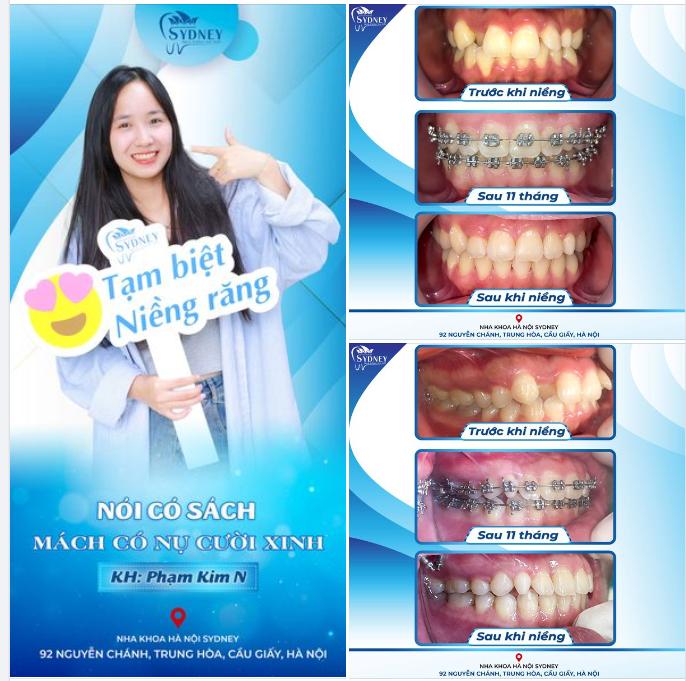 NÓI CÓ SÁCH - MÁCH CÓ NỤ CƯỜI XINH