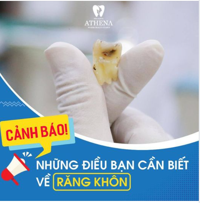 RĂNG KHÔN VÀ NHỮNG HẬU HỌA KHÓ LƯỜNG