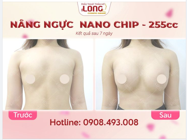 HÀNG NGÀN KHÁCH HÀNG CÓ ĐƯỢC VÒNG 1 MƠ ƯỚC…CÒN BẠN THÌ SAO ?