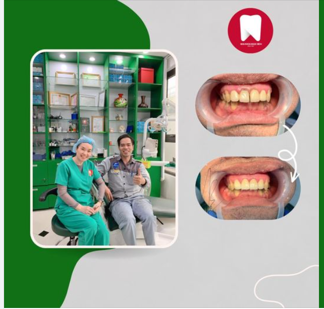 HỐI HẬN VÌ KHÔNG BIẾT ĐẾN NHA KHOA NGỌC BÍCH SỚM HƠN