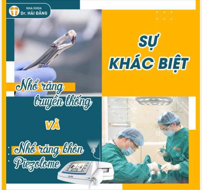 Nếu trước đây, nói đến nhổ răng khôn là nói đến đau nhức, khó chịu, mất ăn mất ngủ…