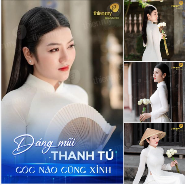 Chị khách hàng đã tin tưởng chọn PKCK Thiện Mỹ để thực hiện nâng mũi