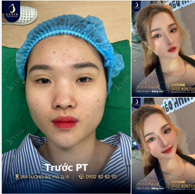 Em gái tự tin khoe góc nghiêng cực xinh