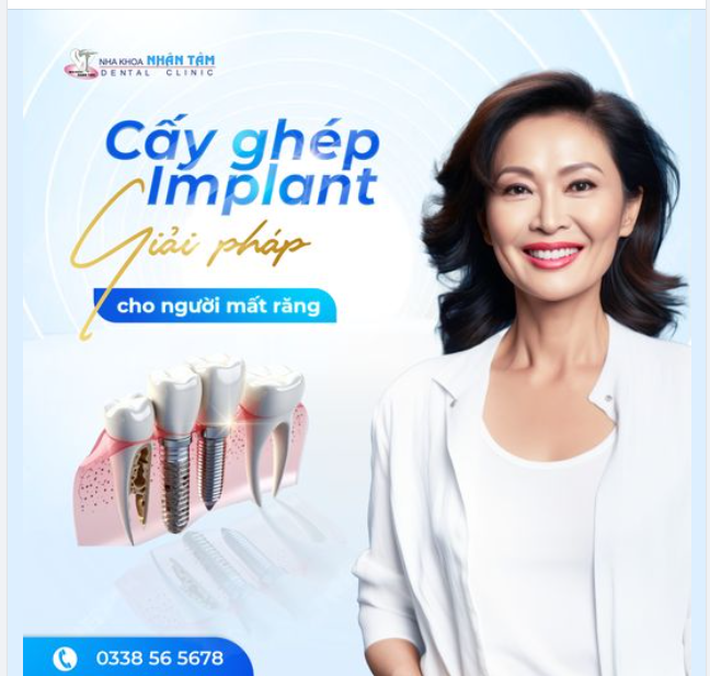 Cấy ghép Implant - Giải pháp cho người mất răng