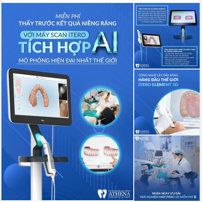 MIỄN PHÍ THẤY TRƯỚC KẾT QUẢ NIỀNG RĂNG VỚI MÁY SCAN ITERO TÍCH HỢP AI DUY NHẤT TẠI ATHENA