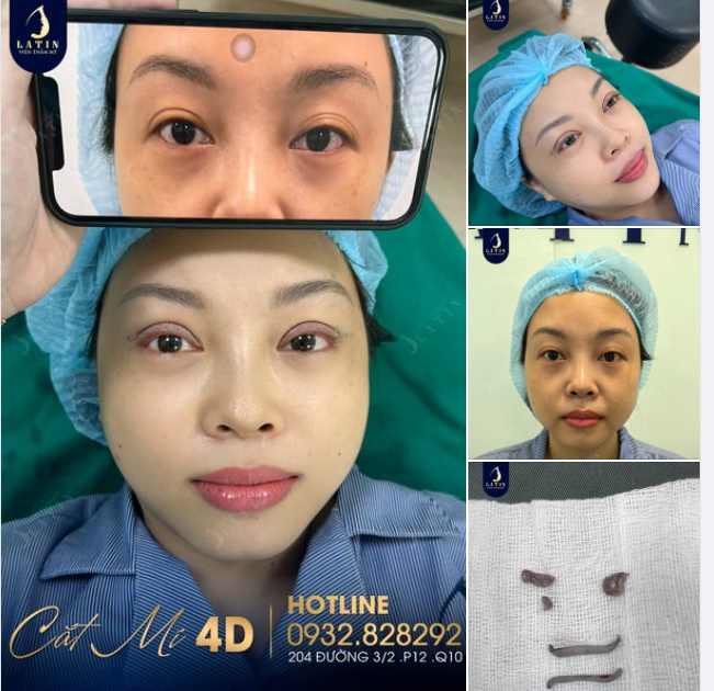 Cận cảnh ca mí 4D vừa hoàn thành tại Latin