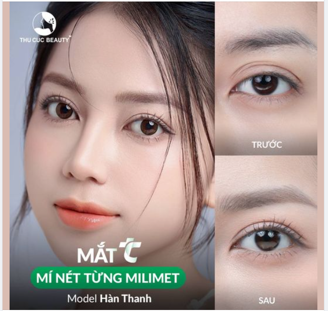 Động lực đi cắt mí là đây