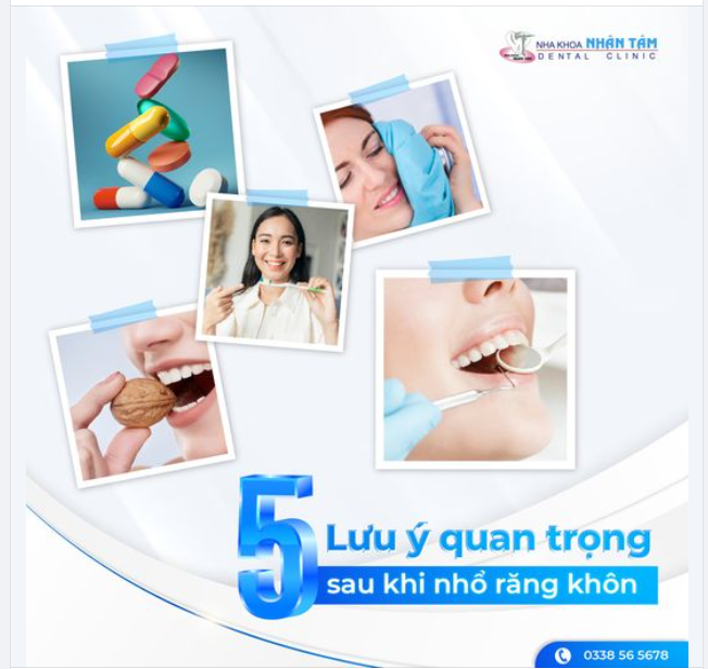 5 lưu ý quan trọng sau khi nhổ răng khôn