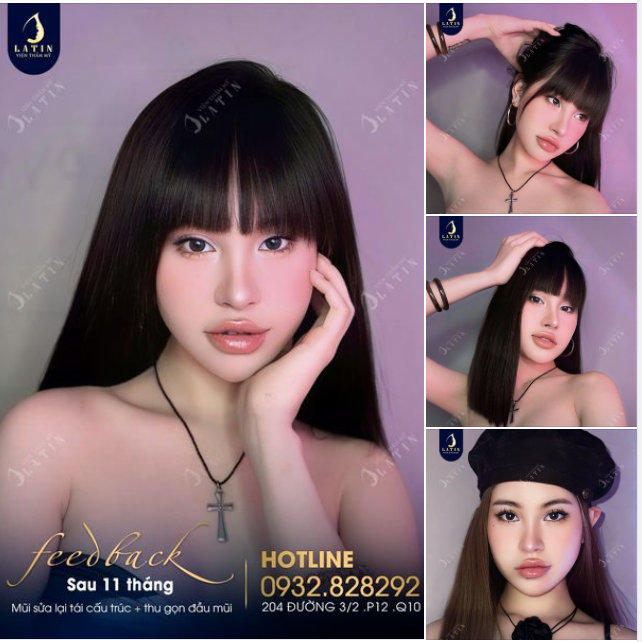 Có thêm những hình ảnh đẹp để truyền động lực cho các bạn đi nâng mũi ngay nào!