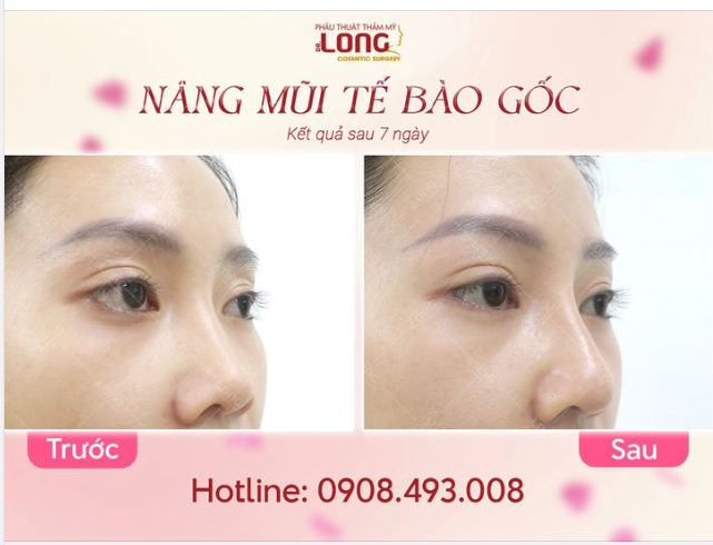 TRA CỨU PHƯƠNG PHÁP LÀM ĐẸP ĐANG THỊNH HÀNH HIỆN NAY