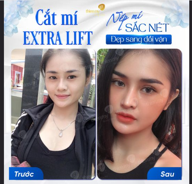 NẾP MÍ SẮC NÉT ĐẸP SANG ĐỔI VẬN