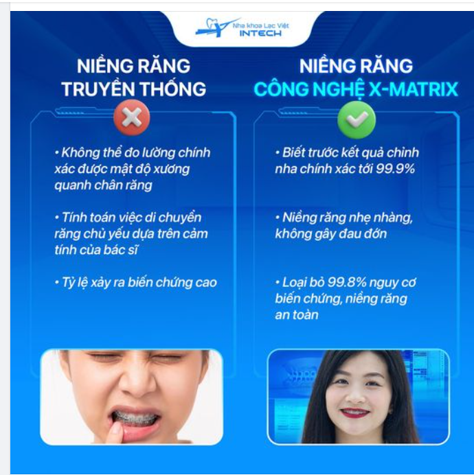 VÌ SAO X-MATRIX ĐANG DẦN THAY THẾ PHƯƠNG PHÁP NIỀNG RĂNG TRUYỀN THỐNG?