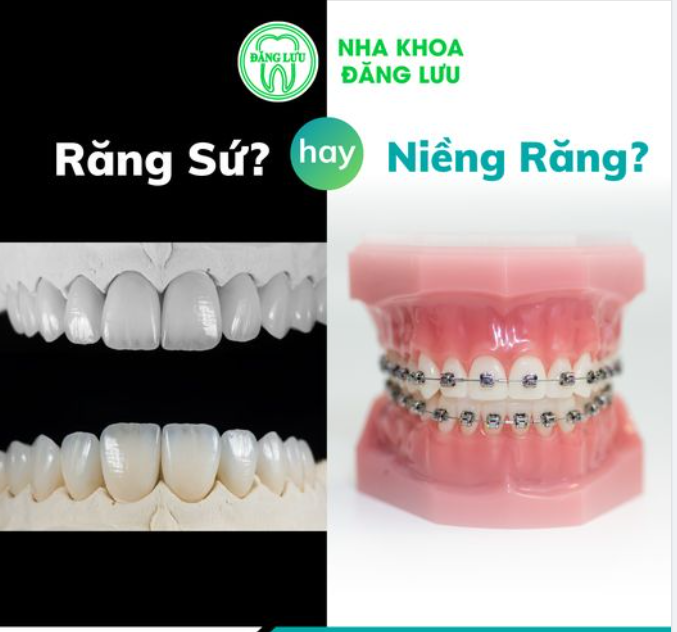 Chúc bạn sớm tìm được nụ cười theo phong cách của chính mình nhé!