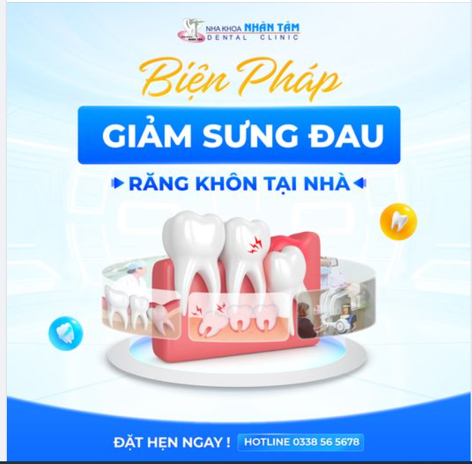 Biện Pháp Giảm Sưng Đau Răng Khôn Tại Nhà