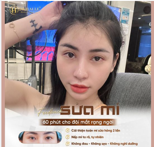 TIN ĐƯỢC KHÔNG? SỬA MÍ LỖI HỎNG KHÔNG SƯNG SẸO