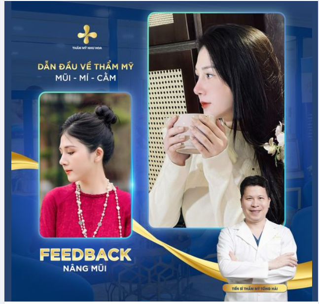 Sở hữu dáng mũi bền đẹp theo thời gian hoàn toàn không khó. Chị em đến với Thẩm mỹ Như Hoa để tư vấn nâng mũi thường đưa ra yêu cầu: