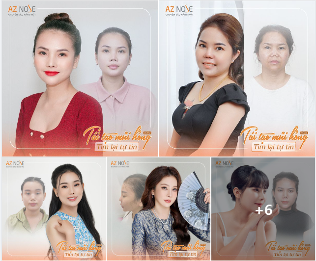 "Tái tạo mũi h.ỏng" - Tìm lại tự tin cùng đội ngũ bác sĩ 14+ năm kinh nghiệm của AZ NOSE tại: https://bit.ly/AZ-taitaomuihong