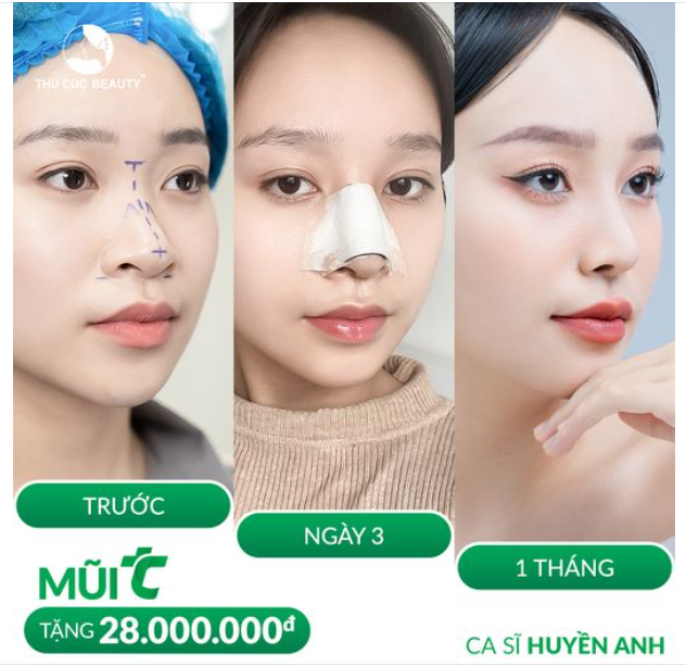 An toàn không bàn chi phí  Mũi TC -30% ngay hôm nay