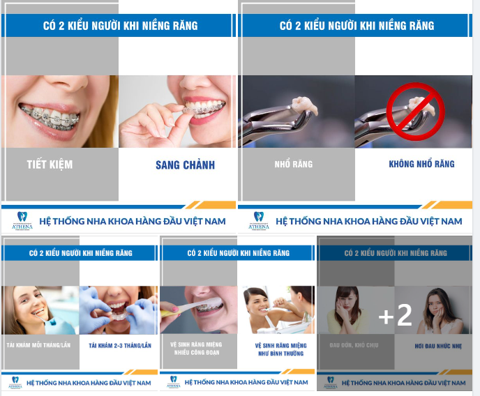 Trên thế giới có 2 kiểu người khi niềng răng