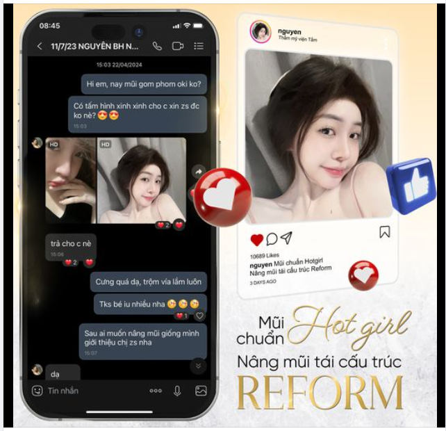 "ĐÁNH THỨC” vẻ đẹp xứng tầm Hotgirl chỉ với 60 phút nâng mũi Tái cấu trúc reform tại Tấm