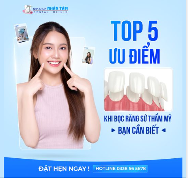 TOP 5 Ưu Điểm Của Bọc Răng Sứ Thẩm Mỹ Bạn Cần Biết