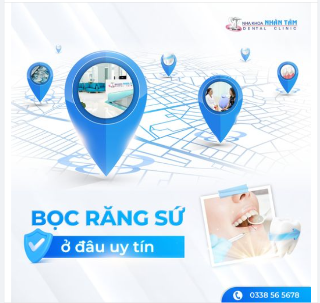 Bọc răng sứ ở đâu uy tín?