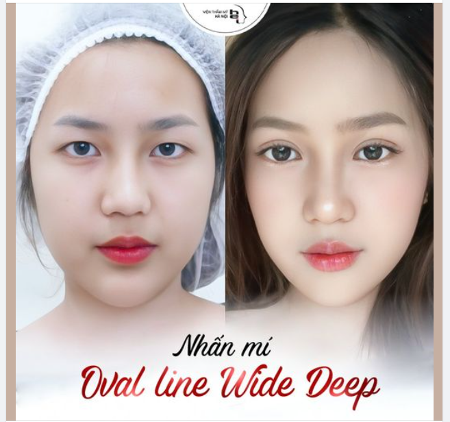 30 PHÚT - MẮT ĐẸP LUNG LINH