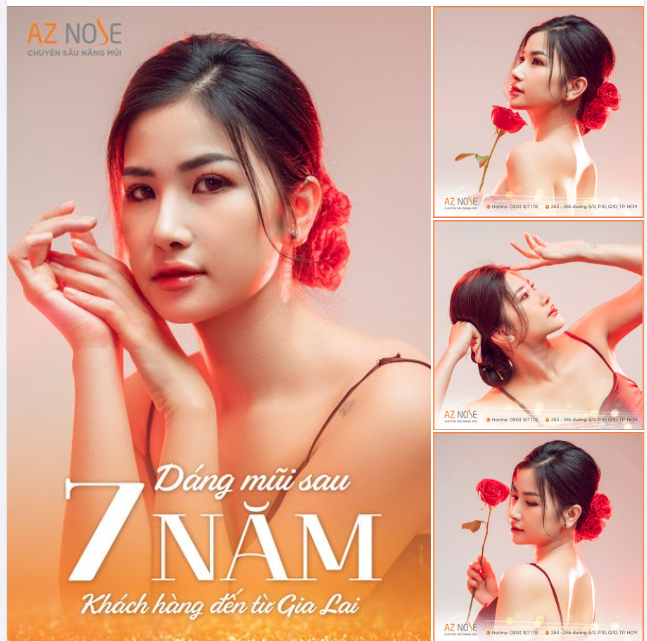 Cảm thấy "xứng đáng" khi đầu tư thay đổi dáng mũi!!