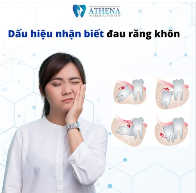 DẤU HIỆU NHẬN BIẾT ĐAU RĂNG KHÔN, CHỚ BỎ QUA!!!