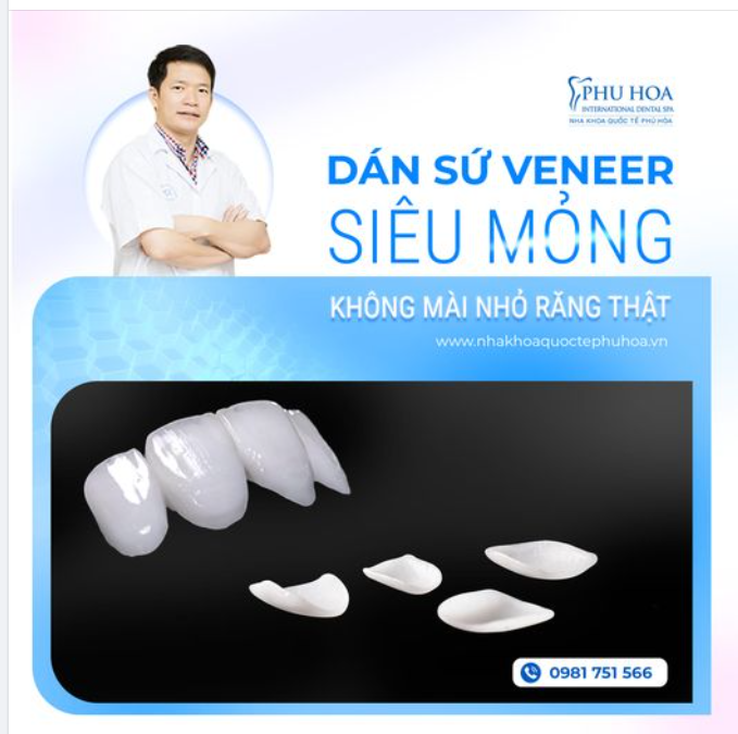 DÁN SỨ VENEER SIÊU MỎNG – KHÔNG MÀI NHỎ RĂNG THẬT