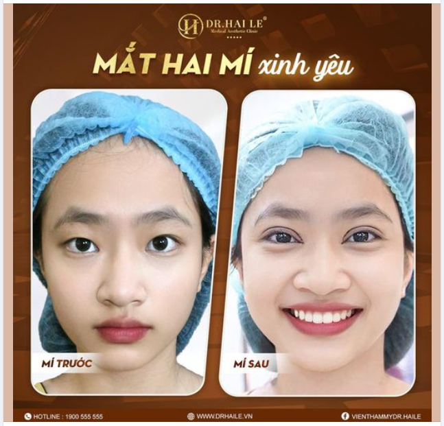 Mí xinh yêu của bạn đâu rồi?