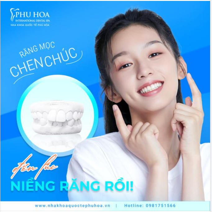 RĂNG MỌC CHEN CHÚC ​​​​​​​ ĐẾN LÚC NIỀNG RĂNG RỒI.